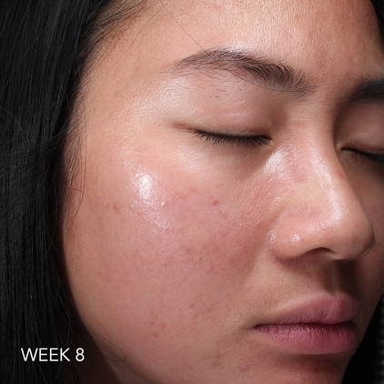 Before and after 2_week 8