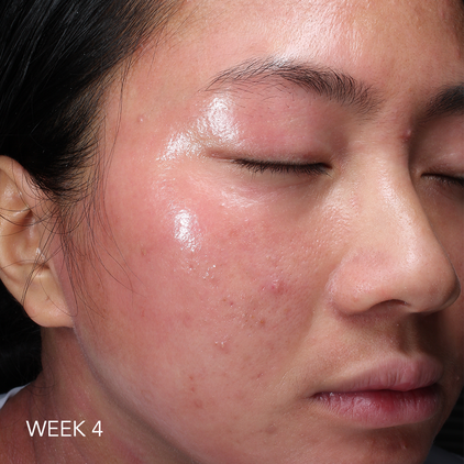 Before and after 3_week 4