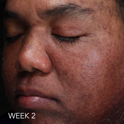 Before and after 2_week 2