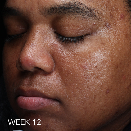 Before and after 2_week 12