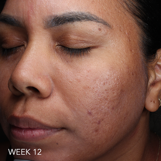 after patient 5
