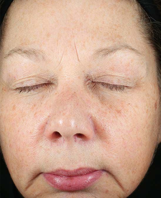 Before and After Image of results from 8 weeks of Daily Power Defense