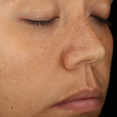 Complexion Clarifying Serum  before-after-3