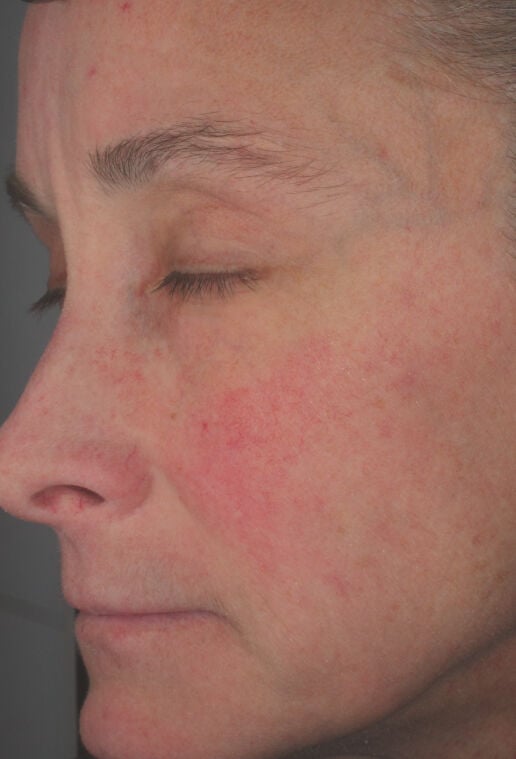 Hydrating Cr&egrave;me  before-after-3