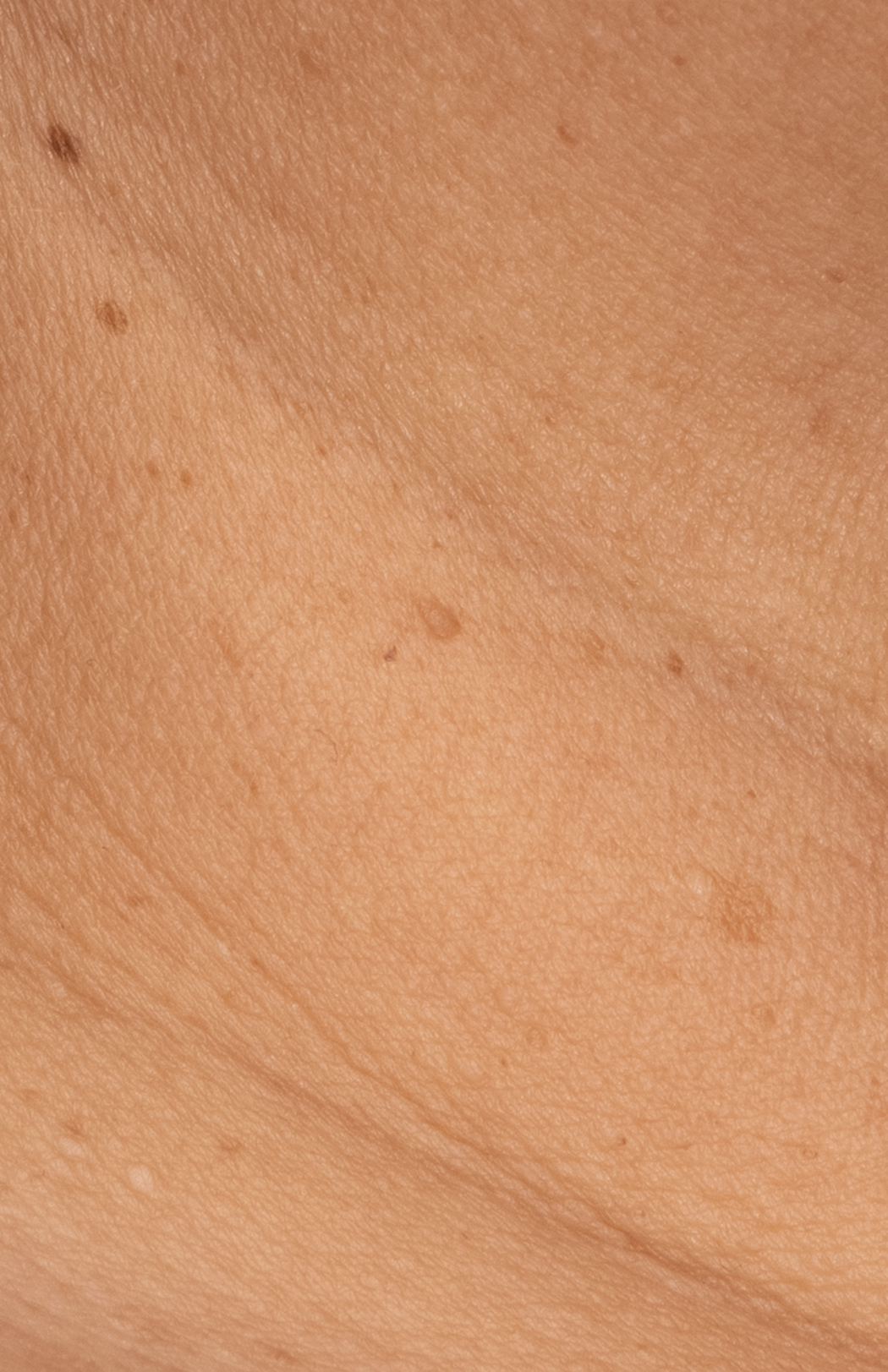 Recovery Cr&egrave;me  before-after-4