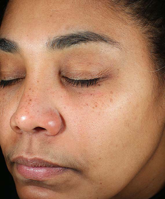 Before and After Image of results from 8 weeks of Daily Power Defense