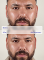 ZO Skin Health Gel Sunscreen Broad-Spectrum SPF 50 Before After 2 num&eacute;ro de l&rsquo;image 6