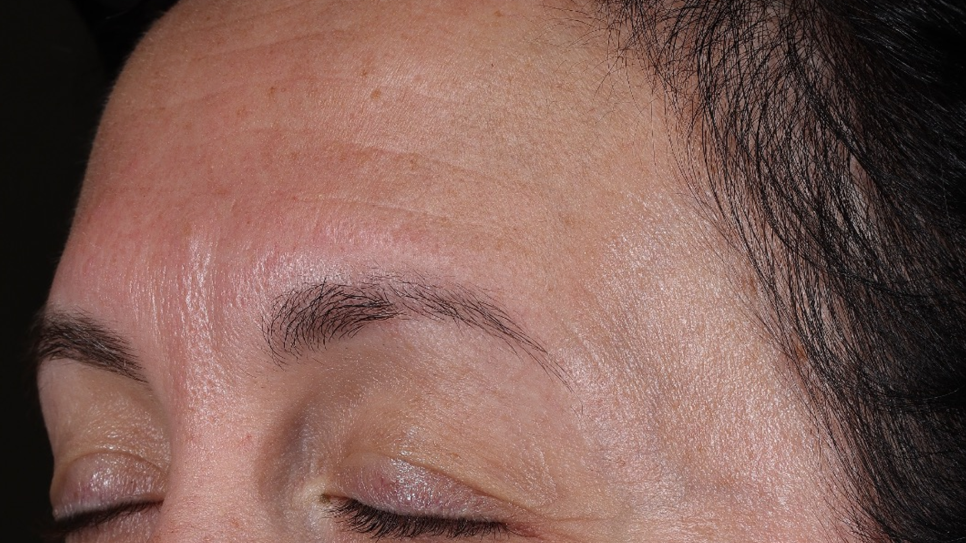 Wrinkle + Texture 0.3  before-after-1