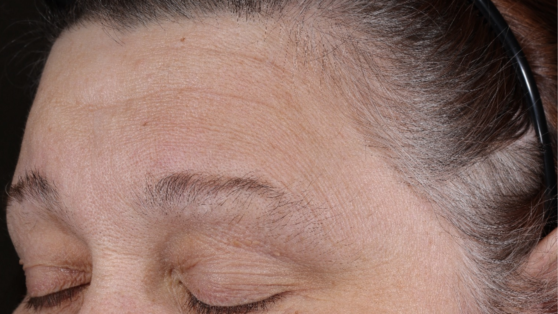 Wrinkle + Texture 0.3  before-after-2