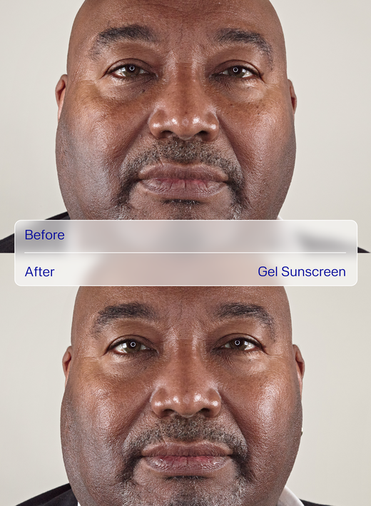 ZO Skin Health Gel Sunscreen Broad-Spectrum SPF 50 Before After 1 num&eacute;ro de l&rsquo;image 5
