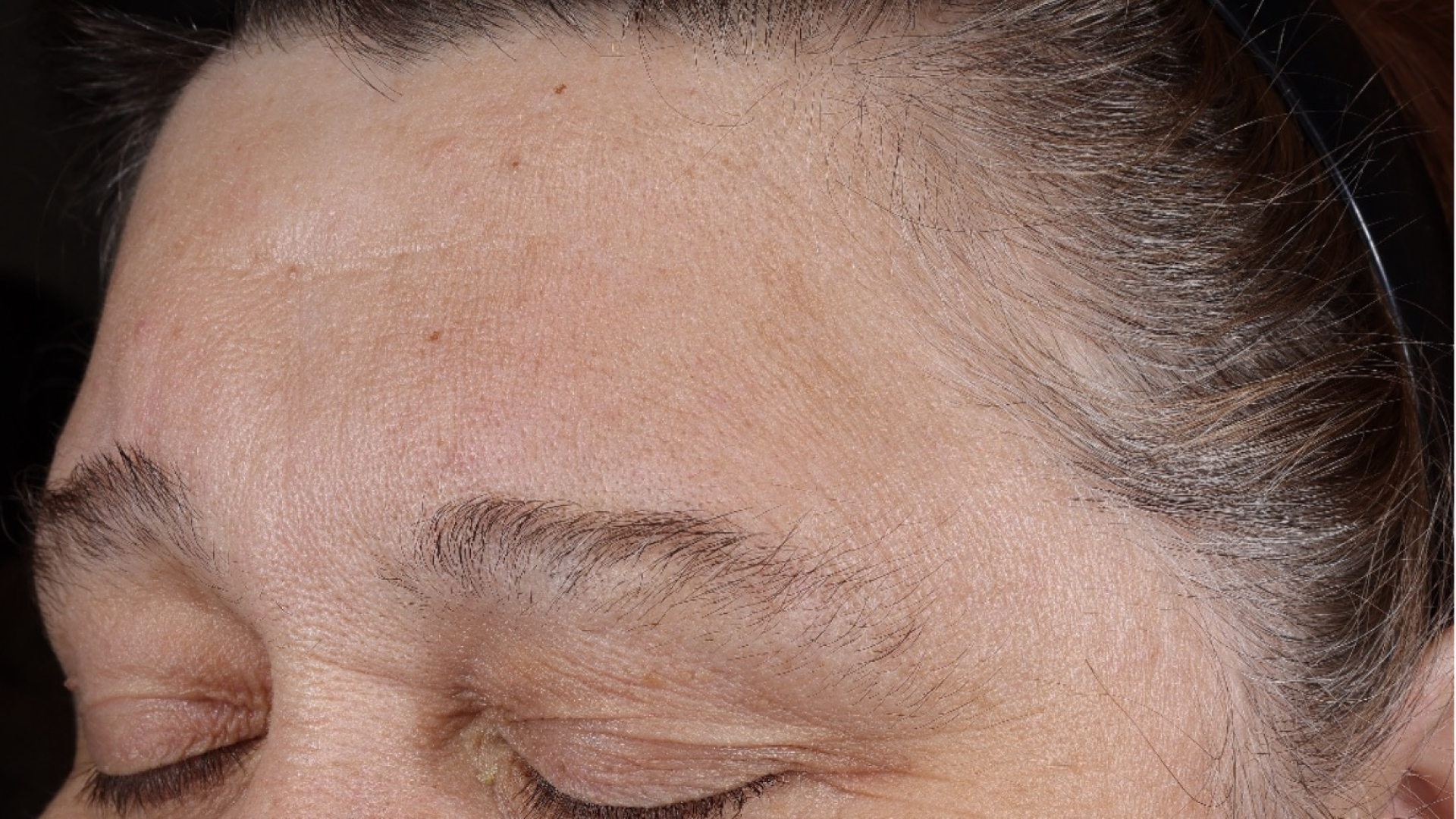 Wrinkle + Texture 0.3  before-after-2