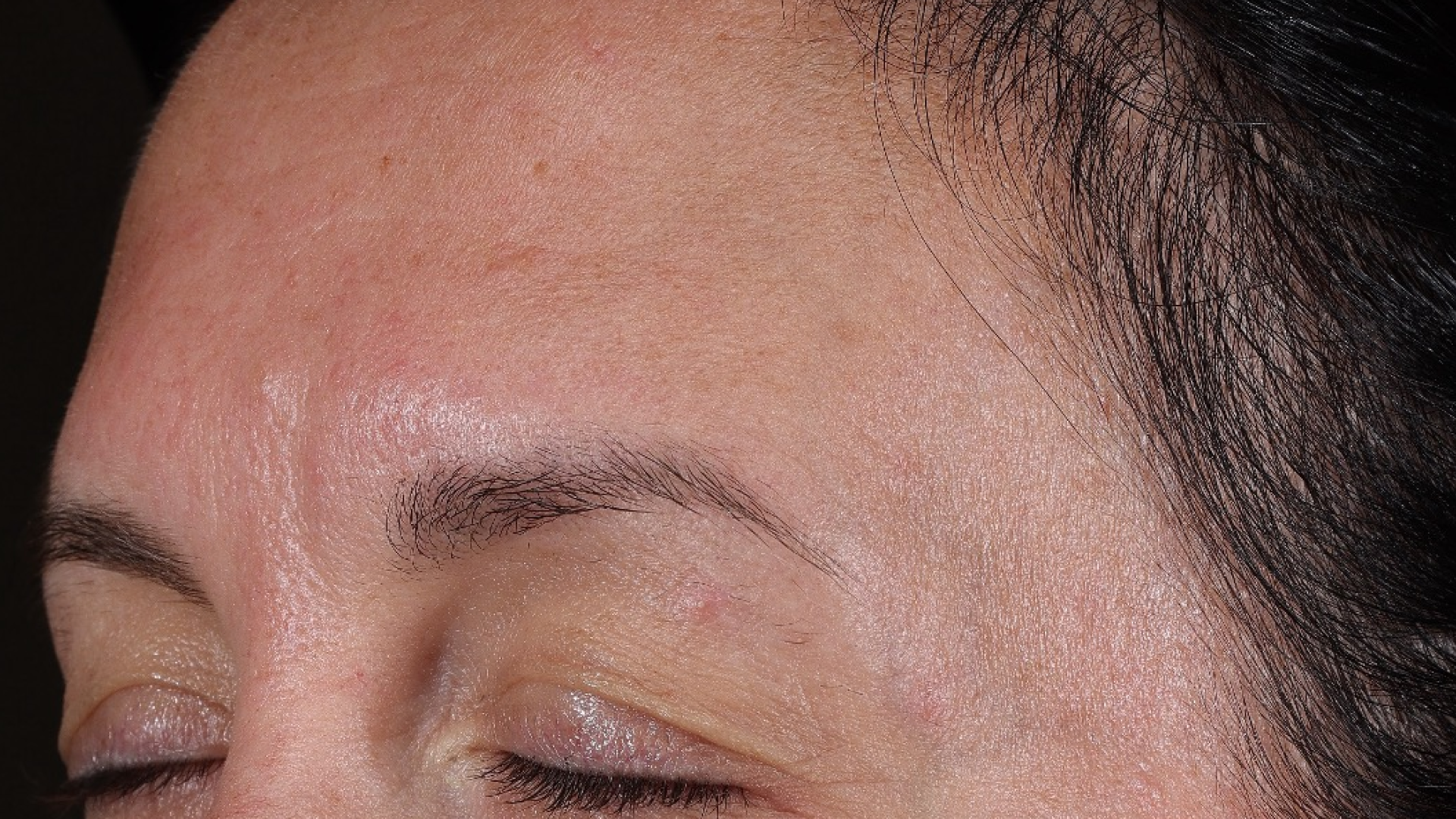 Wrinkle + Texture 0.3  before-after-1