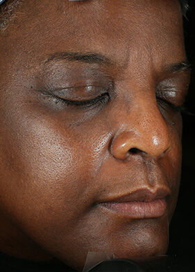 Brightalive&reg; (Travel Size)  before-after-1