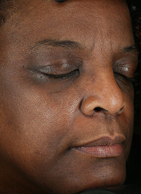 Brightalive&reg; (Travel Size)  before-after-1